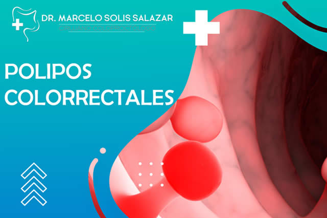 POLIPOS COLORRECTALES EN QUITO